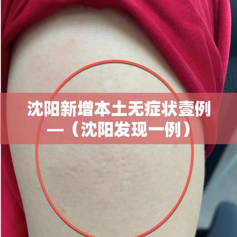 沈阳新增本土无症状壹例—(沈阳发现一例) 沈阳新增本土无症状壹例—(沈阳发现一例)