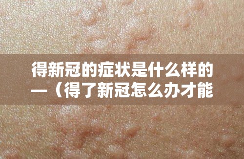 得新冠的症状是什么样的—(得了新冠怎么办才能好得快) 得新冠的症状是什么样的—(得了新冠怎么办才能好得快)